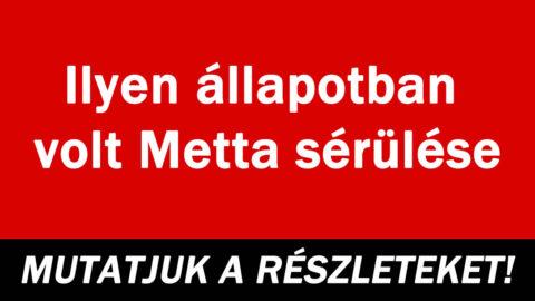 Ilyen állapotban volt Metta sérülése