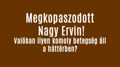 Megkopaszodott Nagy Ervin!